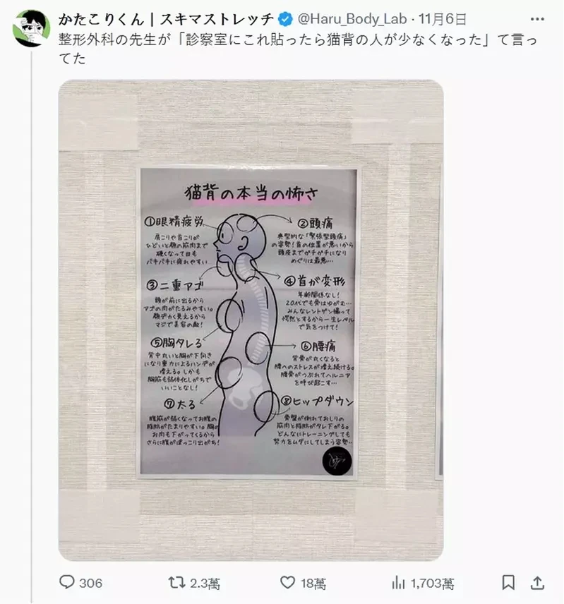 骨科医生的建议《驼背造成的8大影响》请大家随时注意自己的姿势喔