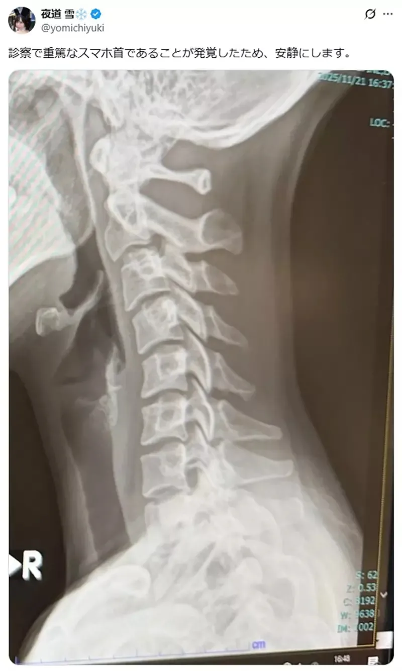 《本田小狼与我》漫画版主角与动画版声优夜道雪在同一天出车祸