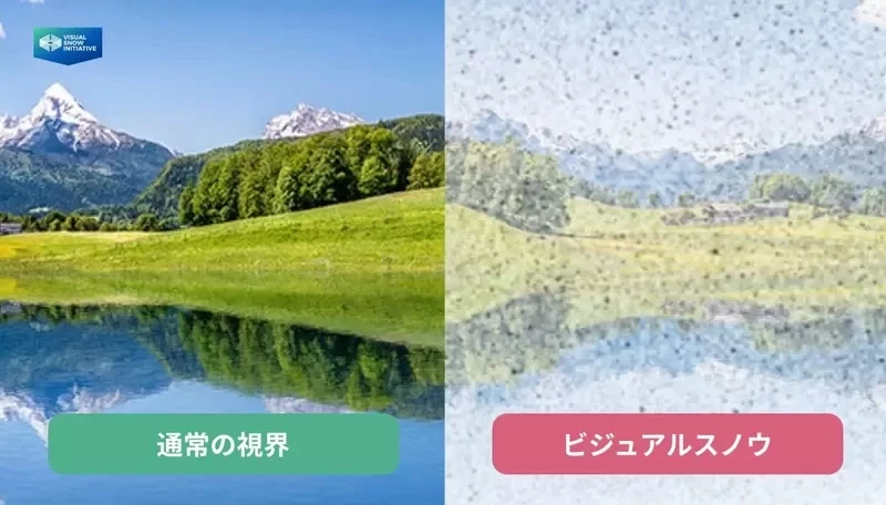 《绘师罹患「视雪症」》眼前闪个不停无法画画了 分享症状希望大家认识这个可怕的疾病